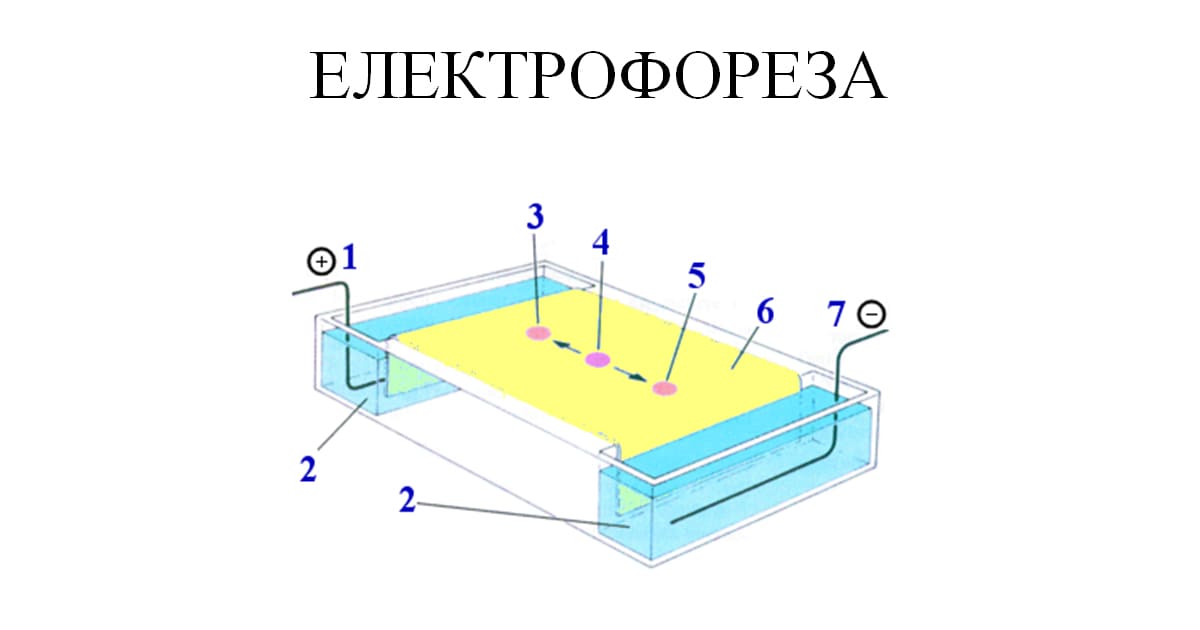 Електрофореза